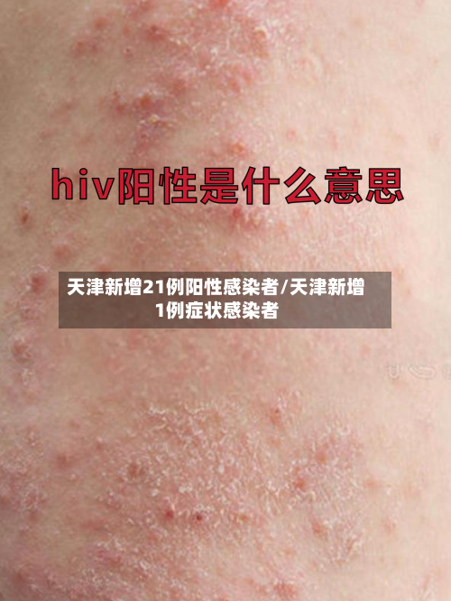 天津新增21例阳性感染者/天津新增1例症状感染者