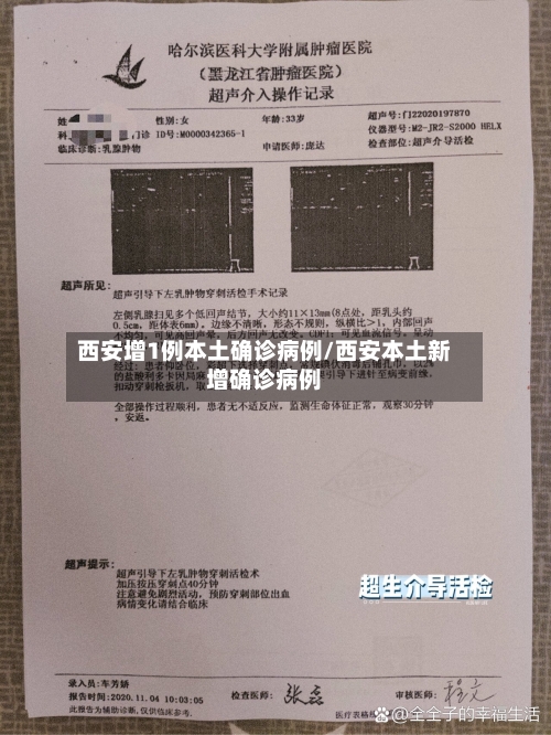 西安增1例本土确诊病例/西安本土新增确诊病例